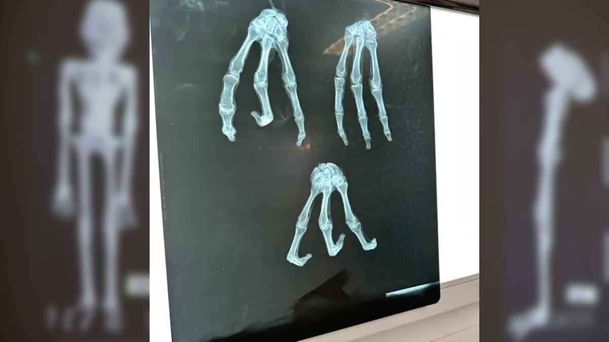 'Uzaylı Mumya'dan parmak izi alındı! Sonuçlar evren hakkındaki anlayışı kökten değiştirecek