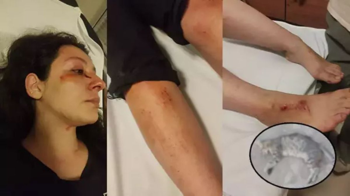 Bursa'da komşu kavgası hastanede bitti: Kediyi öldürüp sahiplerine saldırdılar