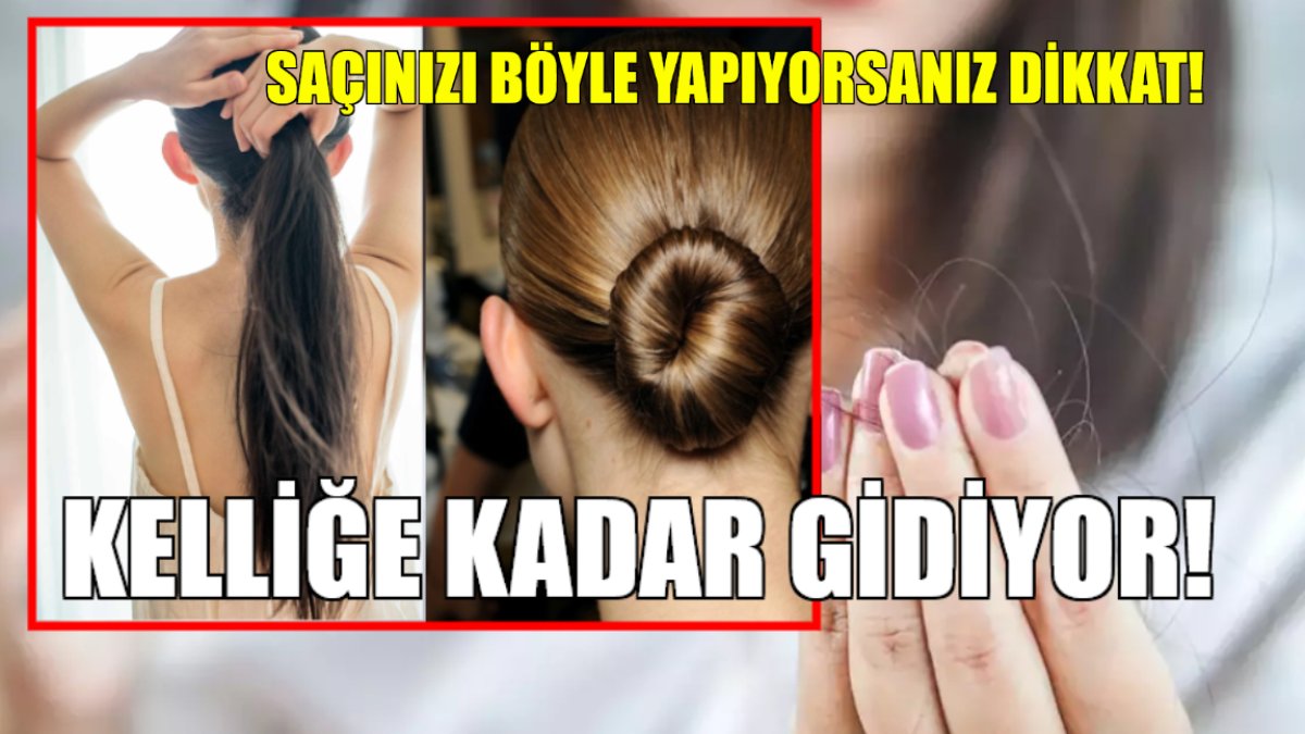 Kadınlar dikkat! Sıcak havalarda bunu yapıyorsanız yandınız: Kelliğe kadar gidiyor