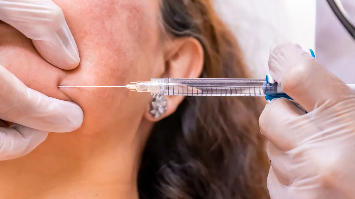 Yanlış botoks yapan uzman, 'taksirle yaralama' suçundan hüküm giydi! Mahkemeden emsal olacak karar