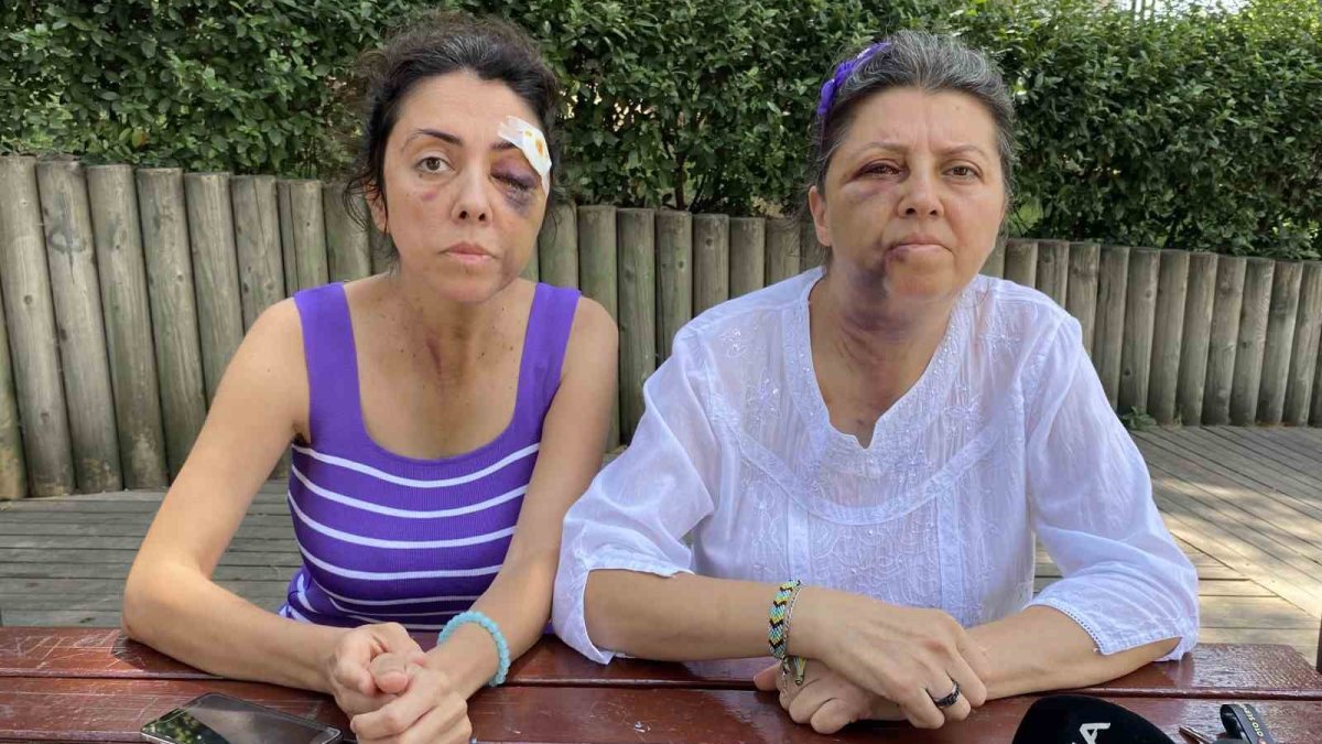 Küçükçekmece'de akılamaz olay: Kedi besledikleri için darp edildiler