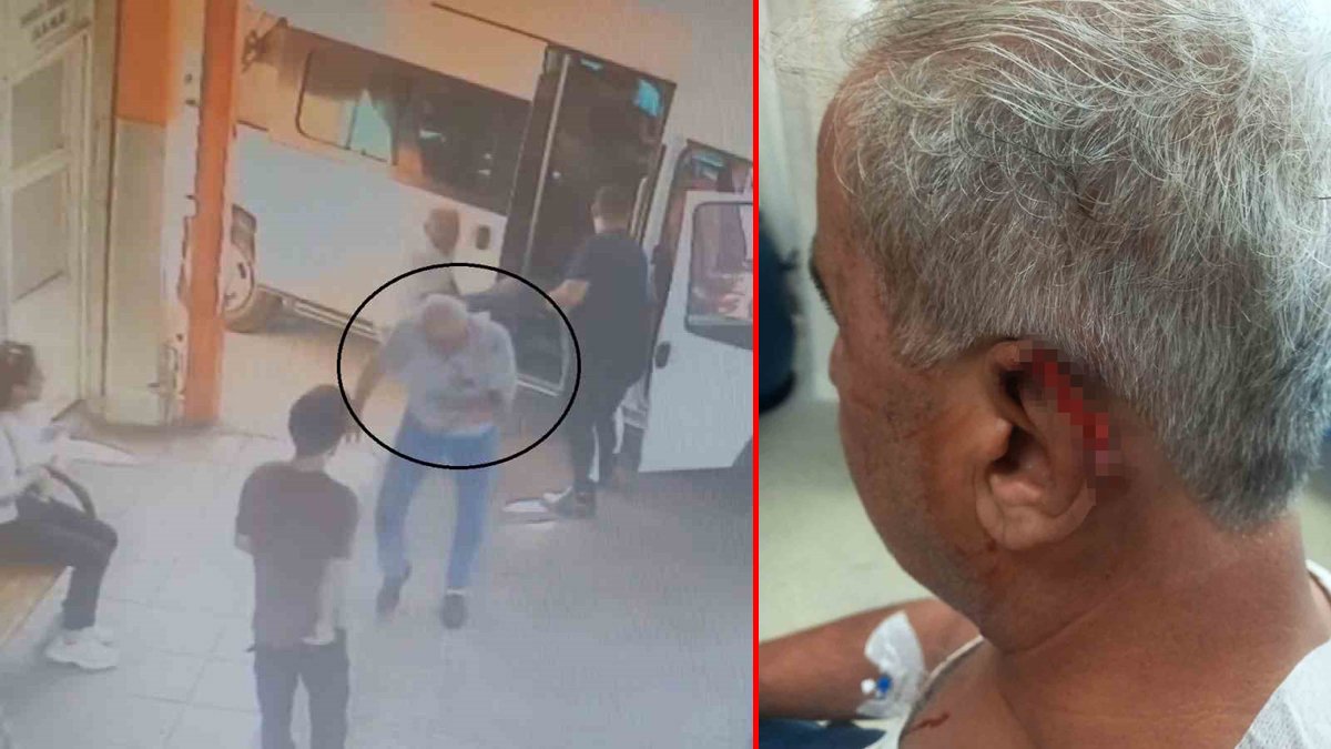 'Lan' tartışması dehşetle bitti: Yolcu, ısırarak minibüs şoförünün kulağını kopardı