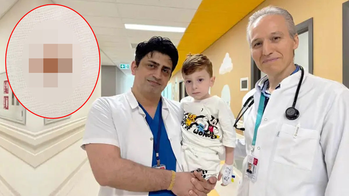 Nefes borusunda sıkışan cisim, doktorları bile şaşırttı! 3 yıl boyunca onunla yaşamış, yeni fark ettiler