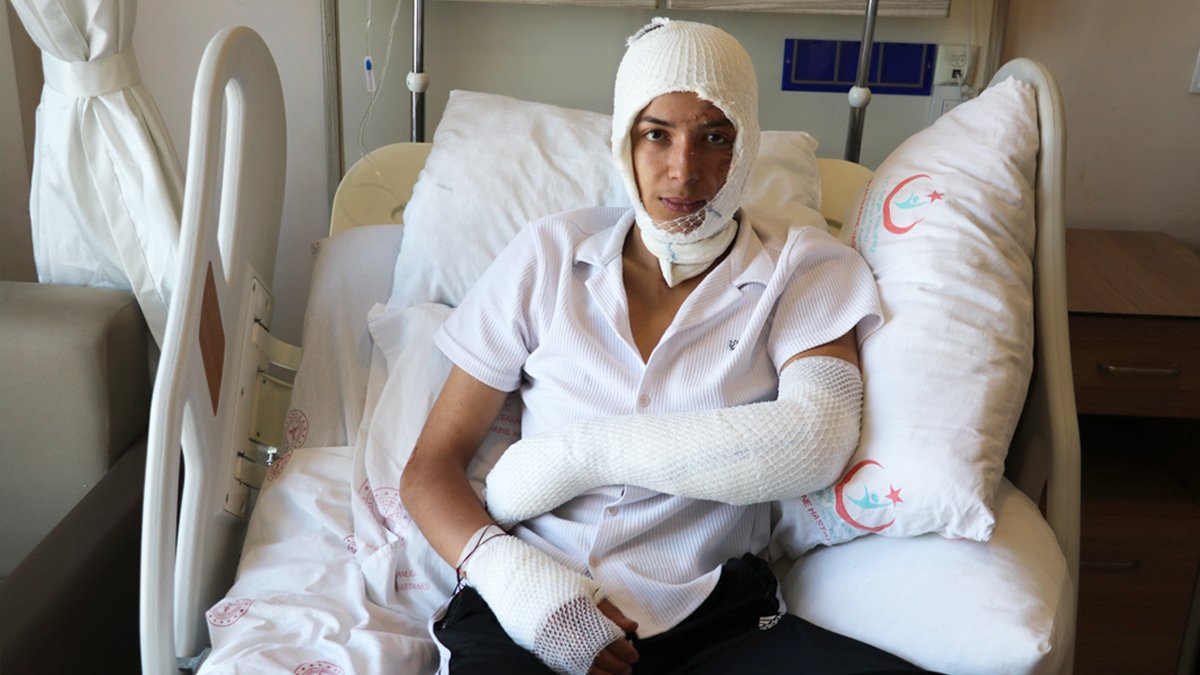 Elektronik sigara yüzünde bomba gibi patladı: Ölümden döndü