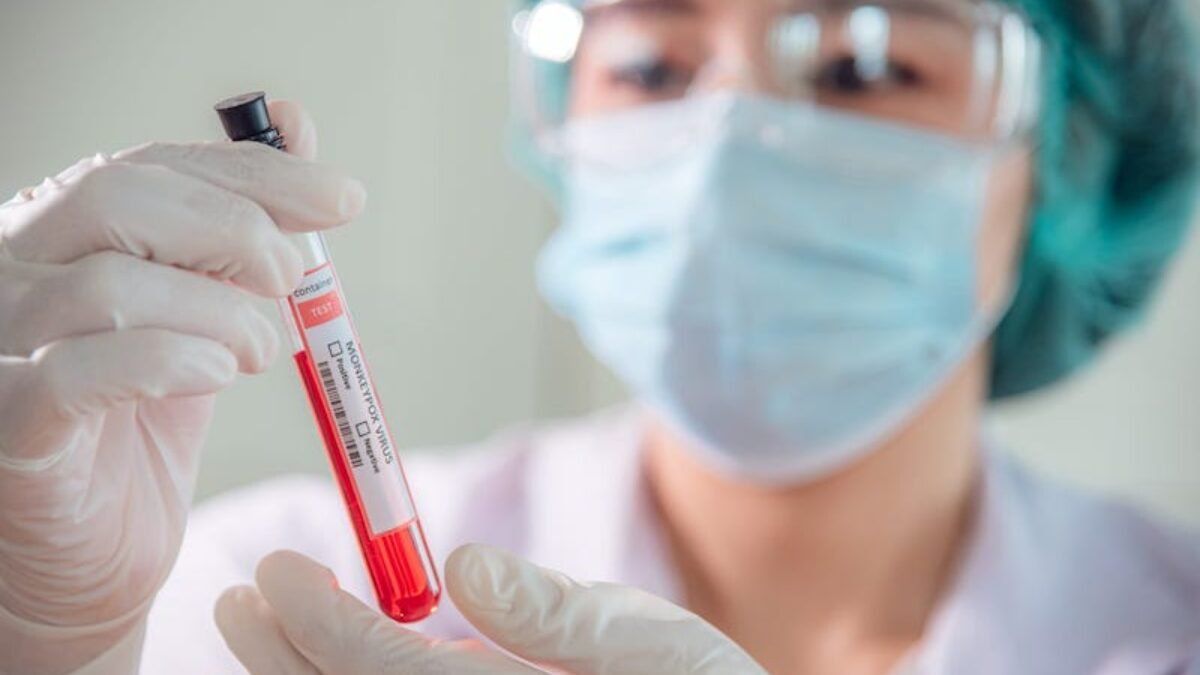 Yıkıcı salgın sınır kapılarını açtı, hızla yayılıyor! Uzmanlar acil uyardı: Yüzlerce kişiyi öldürülebilir