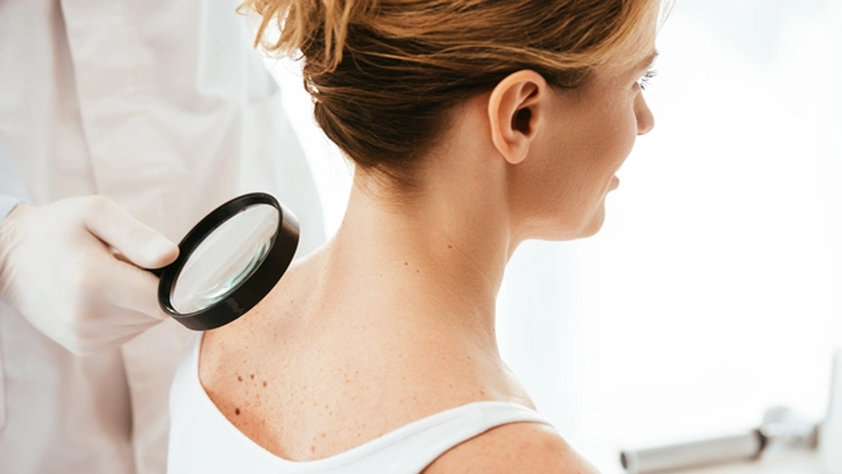 Geç olmadan öğrenin! Vücuttaki kırmızı noktalar o hastalığın habercisi çıktı