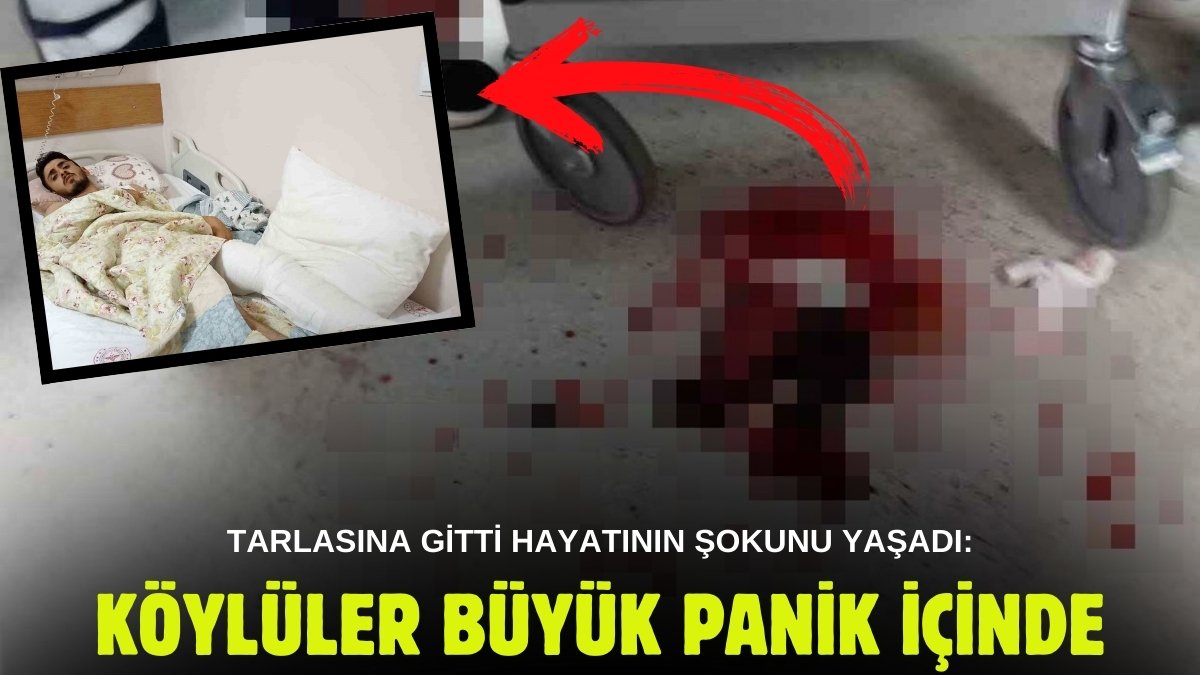 Tarlasını sulamak için giden çiftçi karşısında görünce şok oldu! Bacağından 15 cm'lik dişini çıkardılar