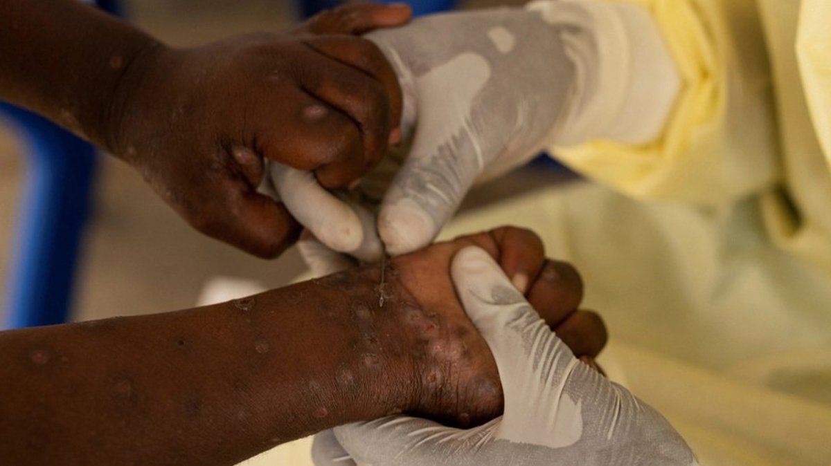 DSÖ tetikte! Afrika'yı sardı: Hızla yayılıyor!