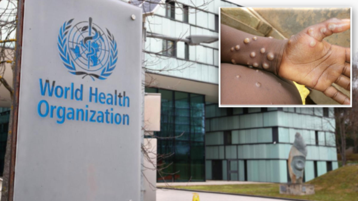 Hızla tüm dünyaya yayılıyor: DSÖ'den maymun çiçeği salgını için küresel acil durum ilanı