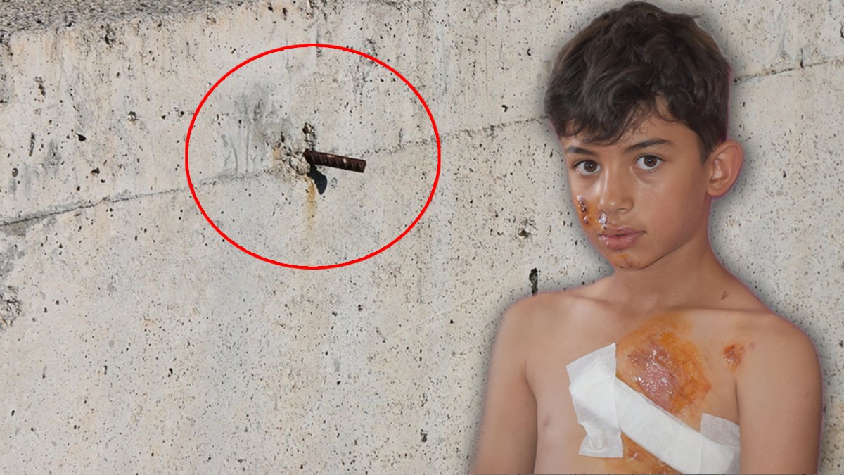 İhmalkarlık can alıyordu: İnşaat demiri göğsüne saplandı