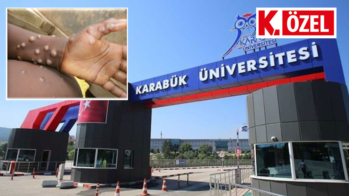 5 binden fazla Afrikalı öğrencisi olan Karabük Üniversitesi’nden maymun çiçeği açıklaması