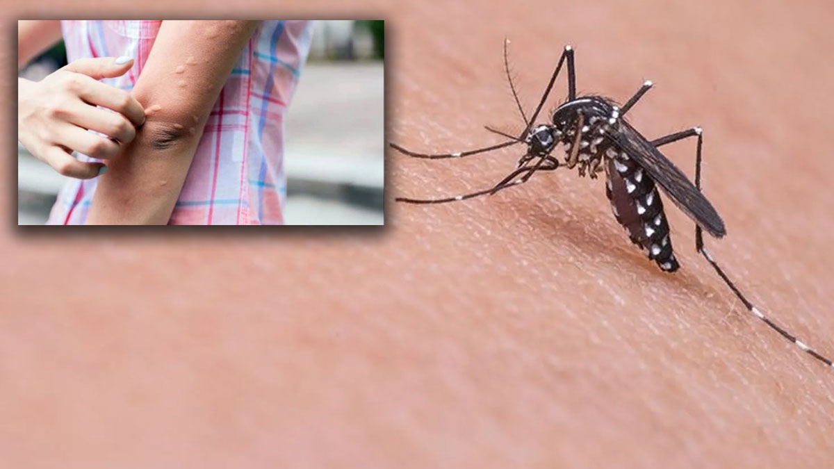 M çiçeği virüsünden daha ölümcül: Batı Nil Virüsü 6 kişide tespit edildi