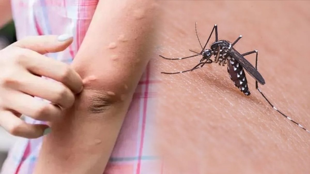 İstanbul'da Batı Nil Virüsü teşhisi konuldu, Bodruma'a tatile gitti