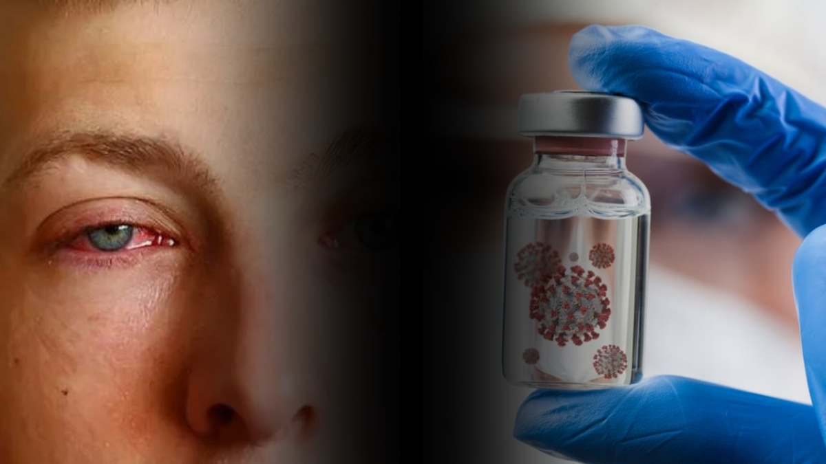 Adenovirüs salgını alarm verdi! Uzmanlardan yeni uyarılar gelmeye devam ediyor: Vakalarda belirgin artış var