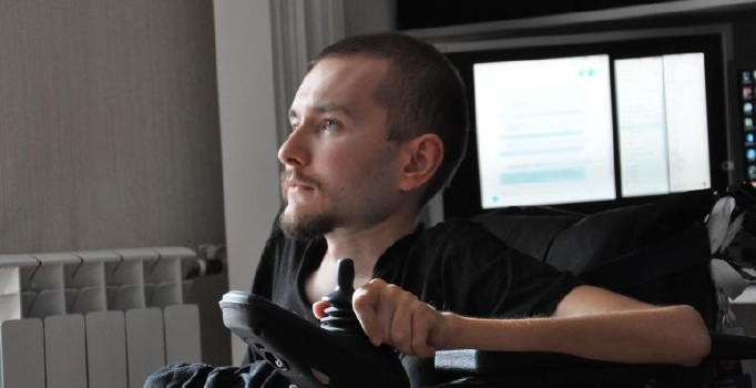 2017 yılında kafa nakli yaptıracak