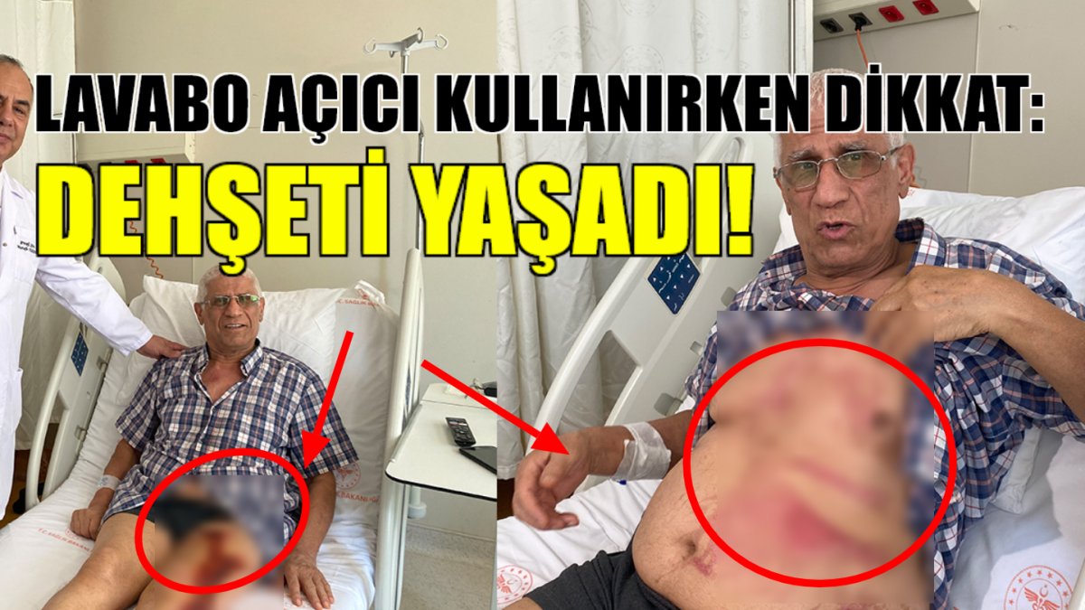 Lavabo açıcı kullanırken dikkat! Bomba gibi bir anda patladı, Uzmanlar uyardı: Bu hatayı sakın yapmayın