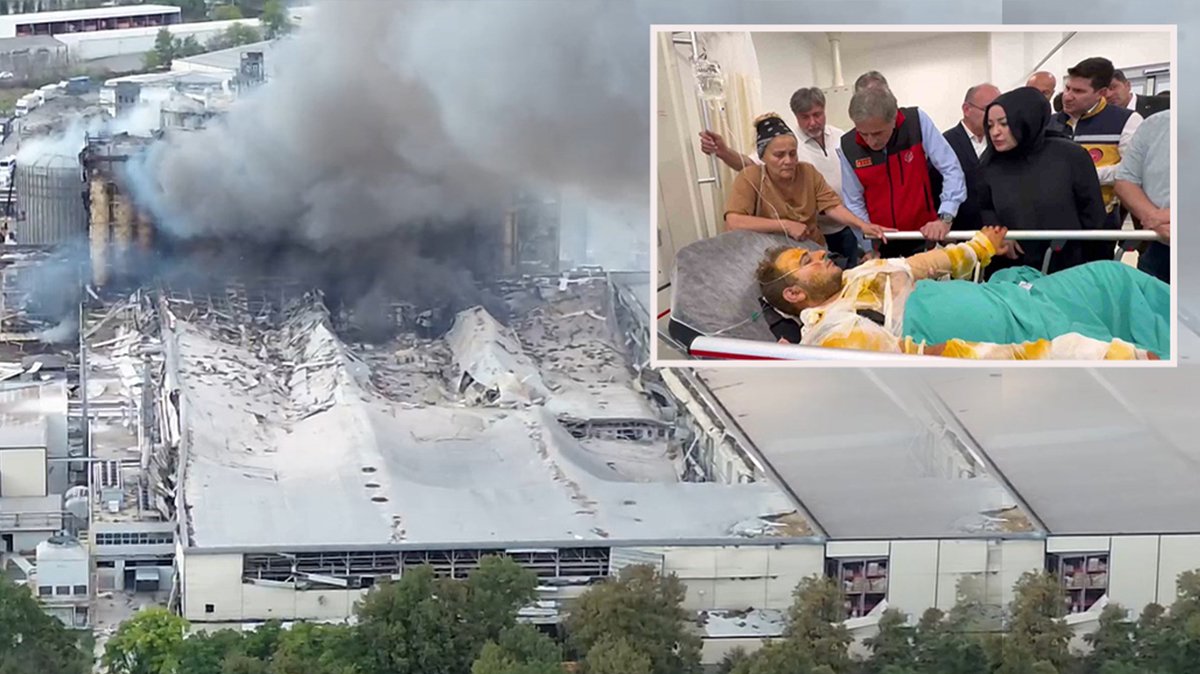 Sakarya'daki patlamadan yaralı kurtulan işçi dehşet anlarını anlattı: Öyle bir patladı ki üstümüzde kıyafet kalmadı...