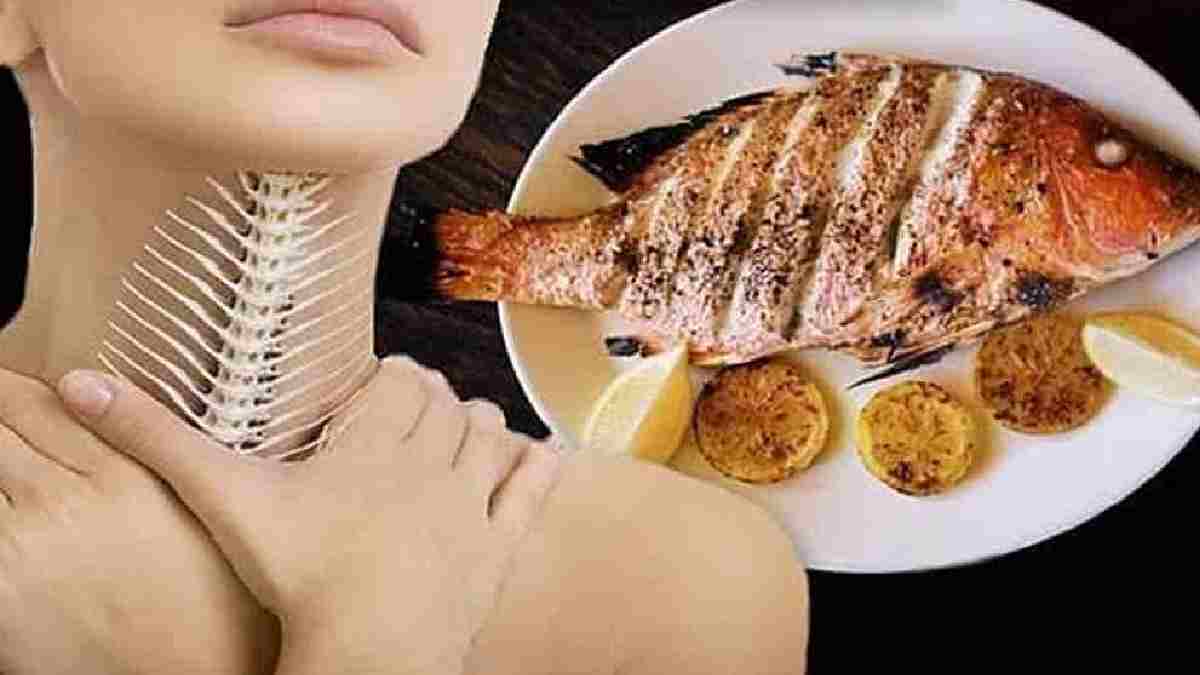 Boğaza takılan kılçıktan bir dakikada kurtulun! Tüyoyu balıkçılar verdi, anında kayıp gidiyor