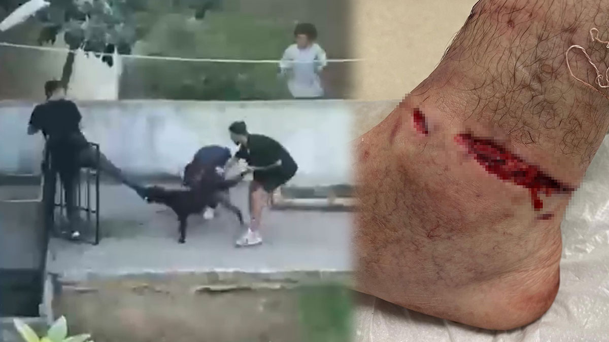 Pitbull dehşeti kamerada: Ayağım koptu zannettim! Pitbull'un sahibi, köpek sahipsiz gibi numara yaptı