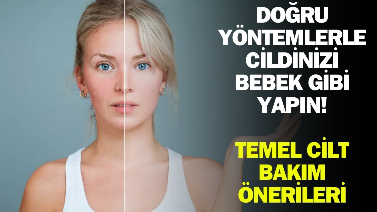 Siyah nokta ve kapalı komedonlar belasına dur deme zamanı! Bu yöntemlerle cildinizi koruyabilirsiniz