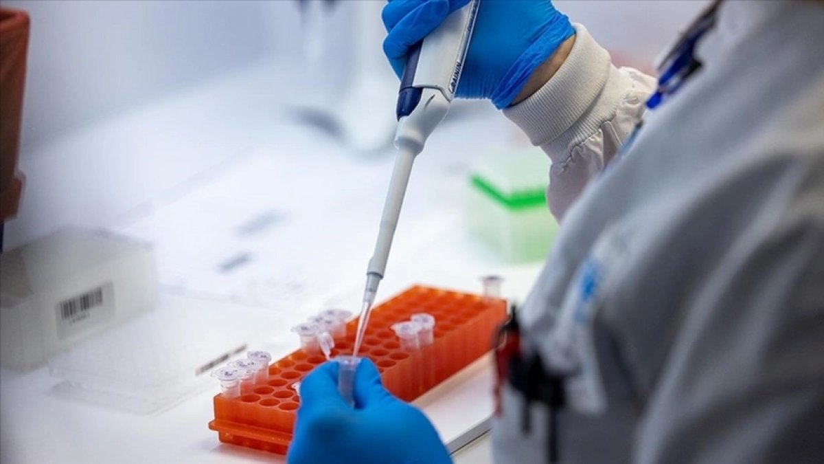 Nijerya'da M çiçeği virüsü salgını büyüyor: 84 vaka kaydedildi