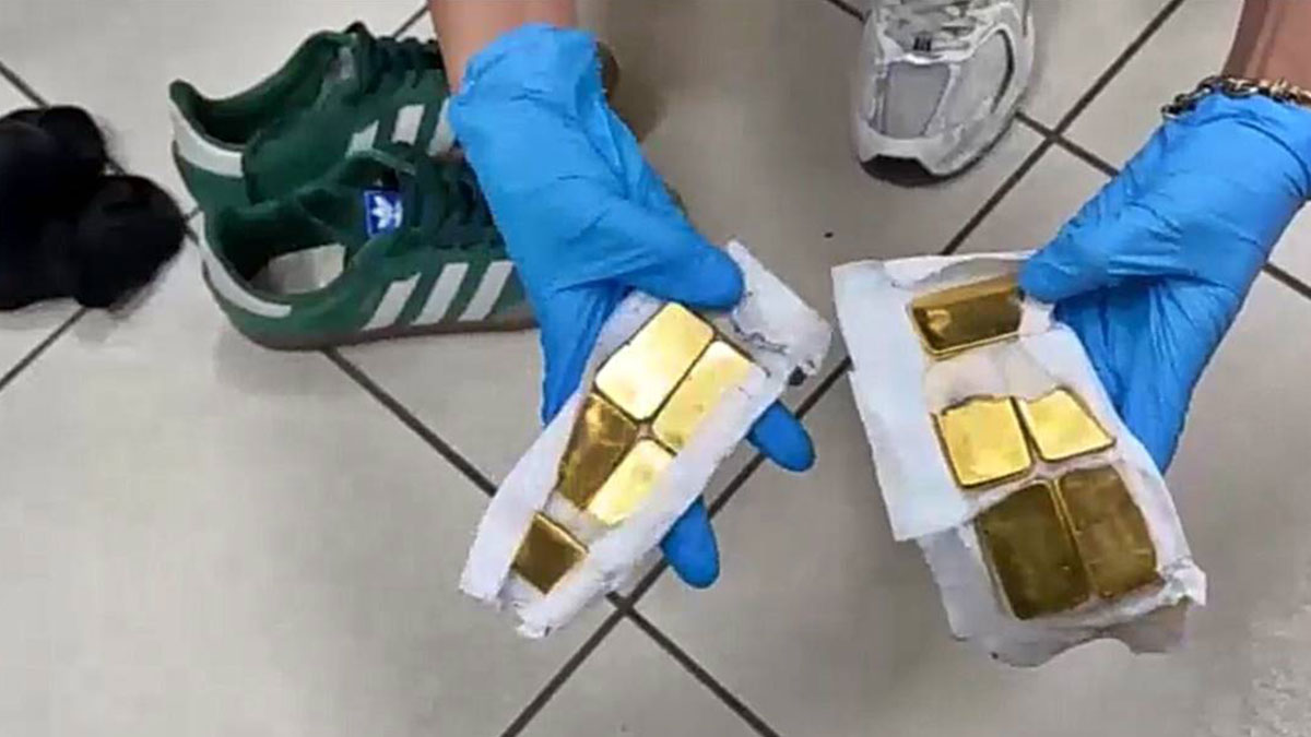 18 kilo altını, cinsel organlarında saklamışlar! Cerrahi müdahaleyle çıkarıldı, 'Pes' dedirten kaçakçılık