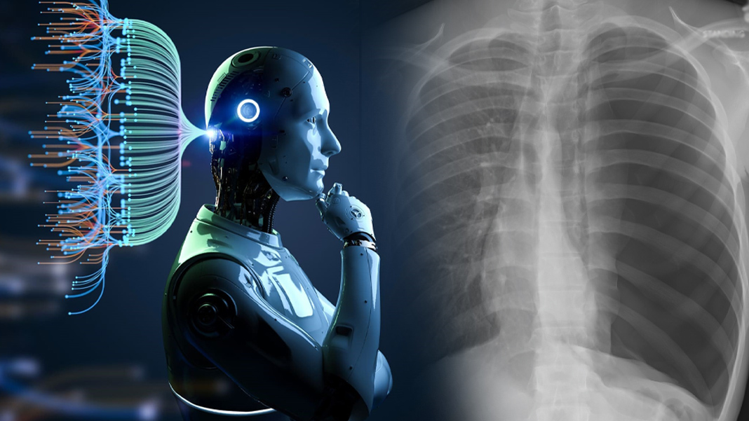Yapay zekanın başarısı bilim dünyasını şaşırttı: ChatGPT, röntgen üzerinde hızlı ve doğru teşhis koydu