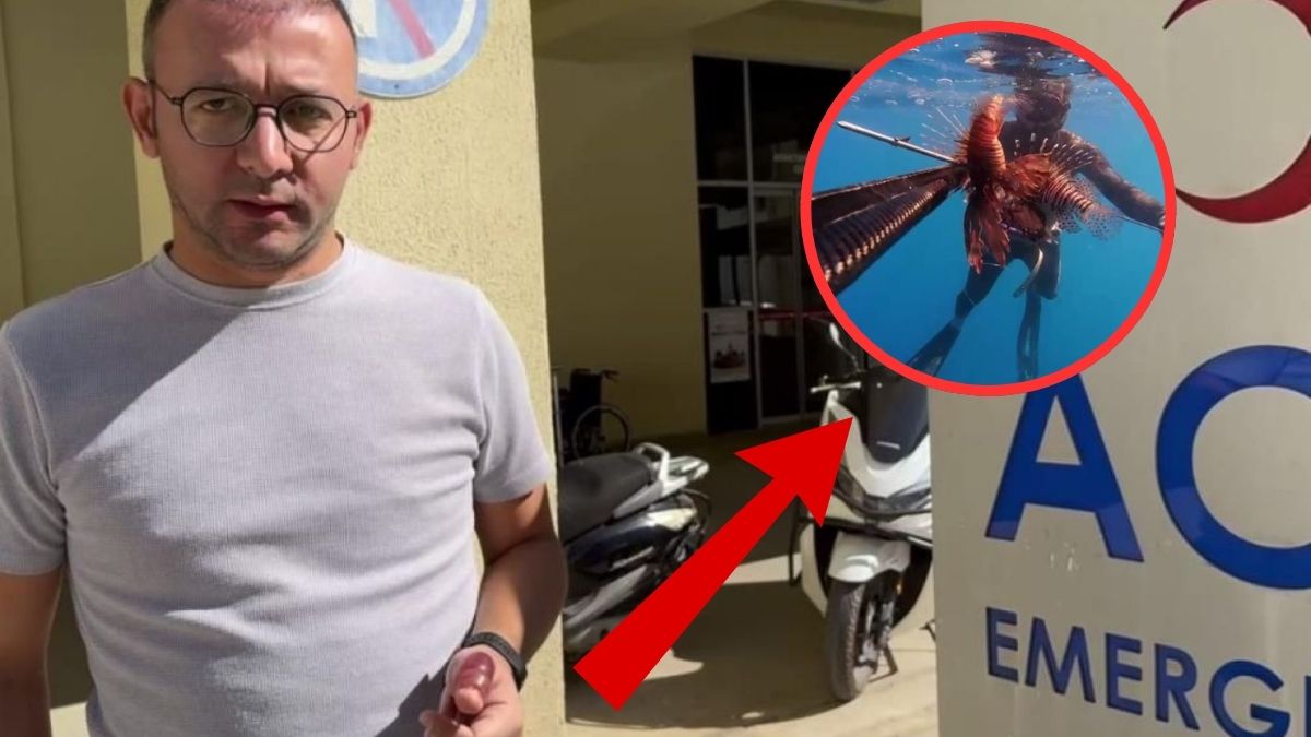 Ölü sandı, dokunduğu gibi hastanelik oldu! Görürseniz parmağınızı bile değmeyin: Dikeni battığı gibi zehirliyor