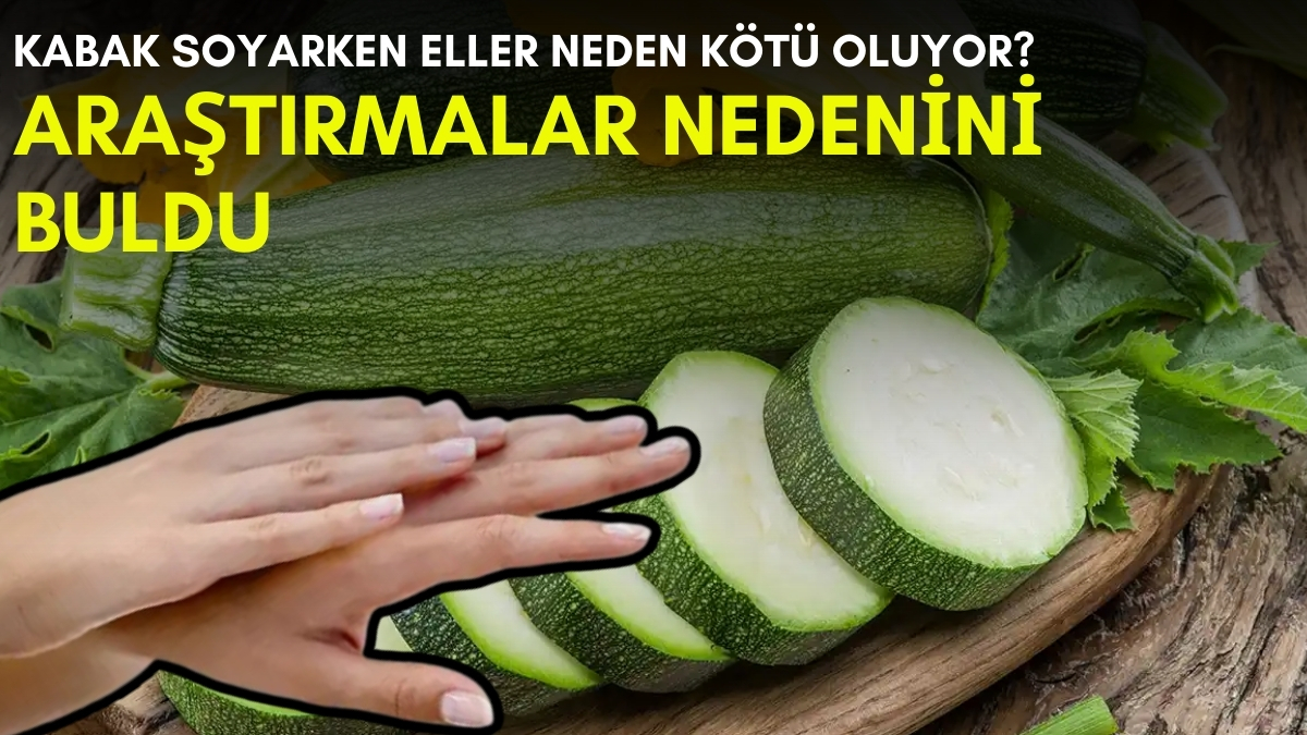Kabak keserken elleriniz kuruyup geriliyorsa dikkat! Nedeni bakın neymiş? Bu yöntemle hemen eski haline dönüyor