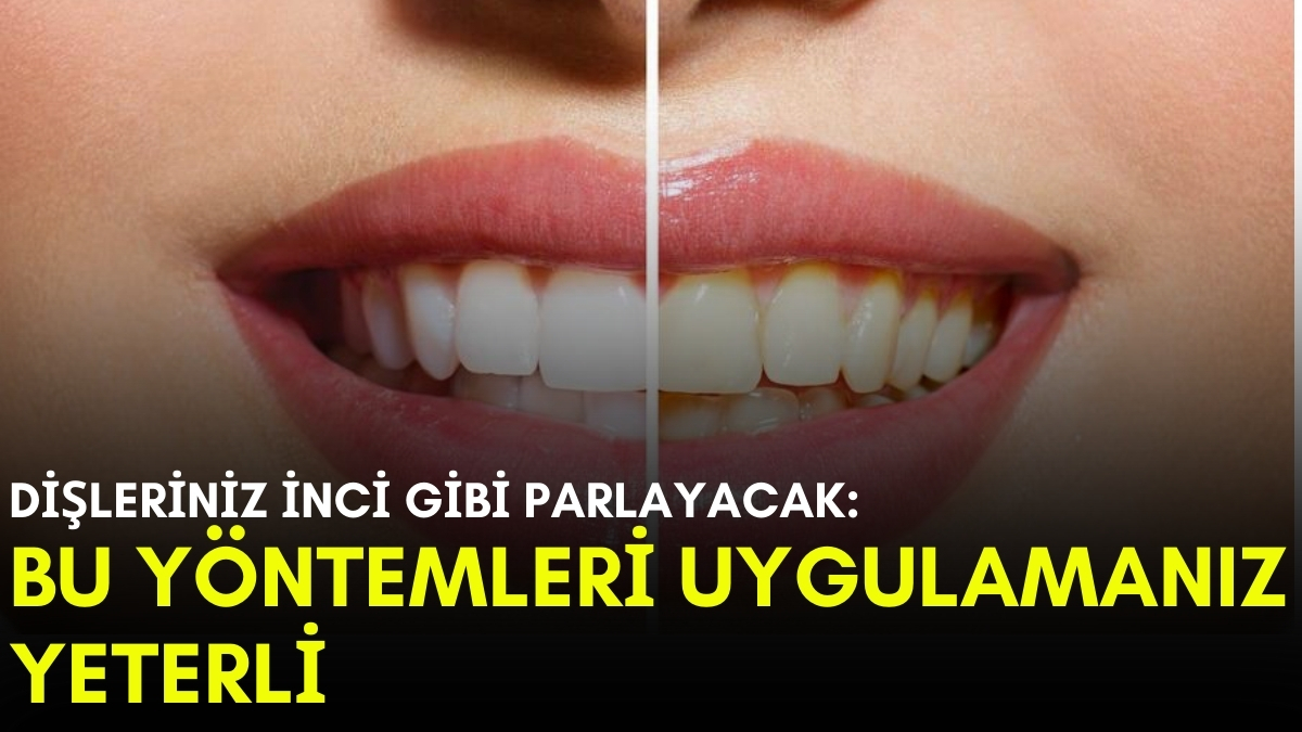 Ne çay ne kahve dişlerinizi sarartmayacak! Güldüğünüzde inci gibi parlayan dişlere sahip olmak çok basit: İşte yöntemleri…