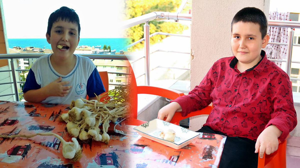 'Sarımsak çocuk' görenleri duyanları hayrete düşürdü! Hayata sarımsakla tutunuyor