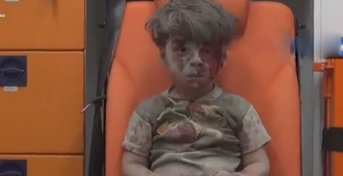 Suriyeli küçük Ümran'ın bakışları yürek parçaladı