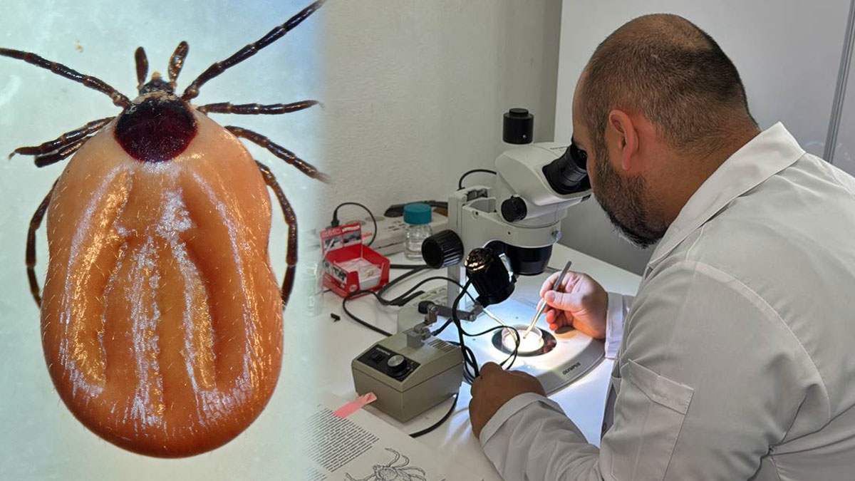 Korkulan oldu: O bakteri Türkiye'de görüldü! Ciddi hastalıkların tanısını engelliyor