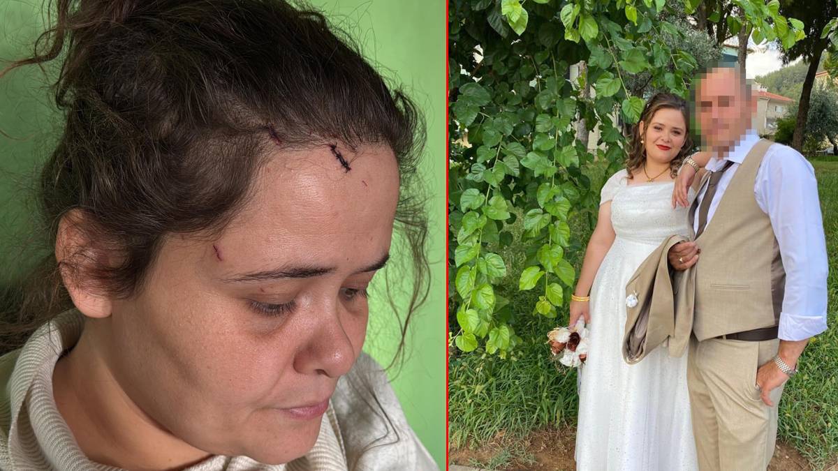 Eşi tarafından darp edilen Keziban'ın çağrısı: Serbest bıraktılar, can güvenliğimden endişe ediyorum