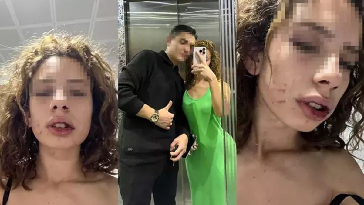 Kız arkadaşını bayıltana kadar dövüp arkadaşına telefon açtı: Mezar hazırlar mısın?