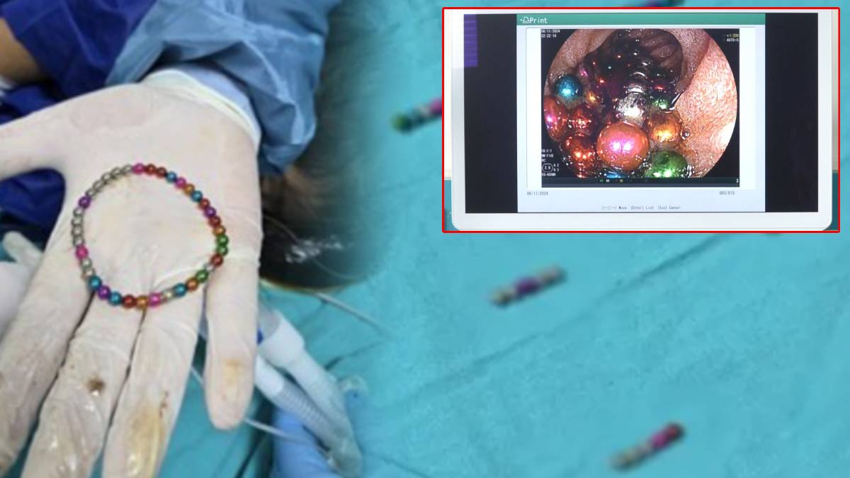5 yaşındaki çocuğun bağırsağından 38 mıknatıs çıktı