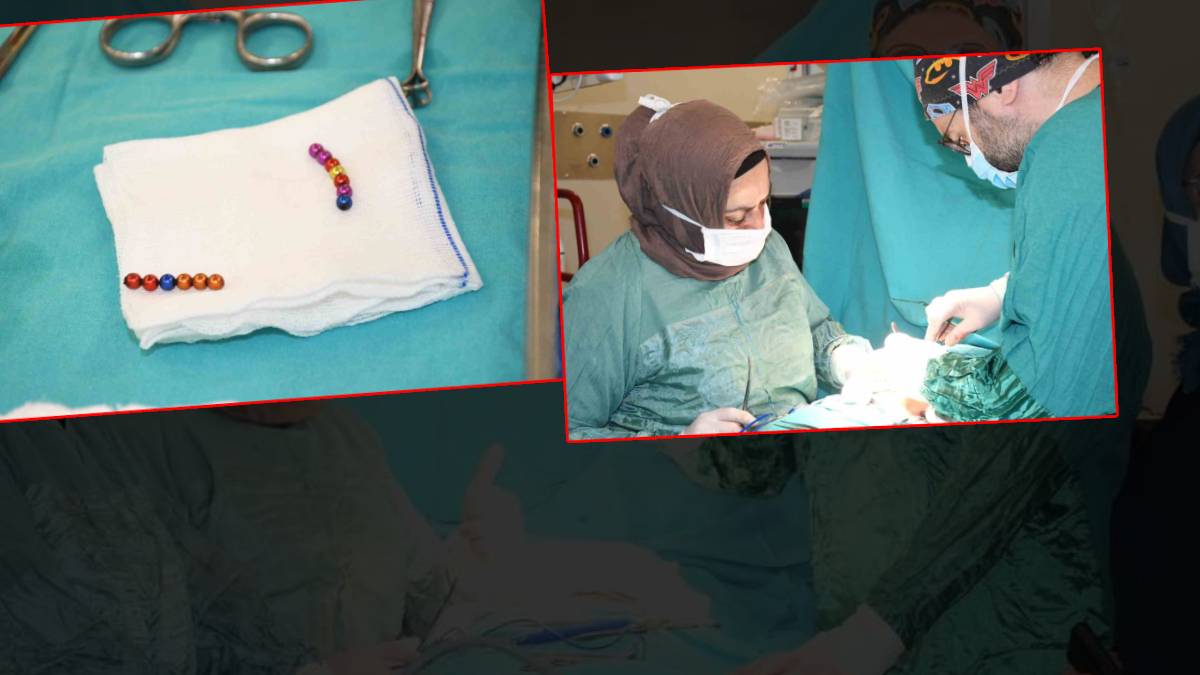 4 yaşındaki çocuğun bağırsağından 13 mıknatıs çıktı
