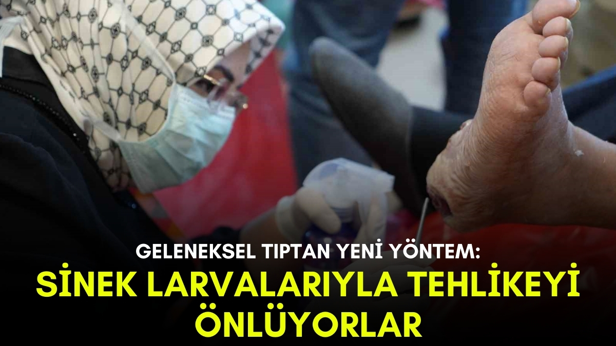 Sineğin larvasıyla tedavi ediyorlar! Kesilmesini önlüyor, iyileşmesini sağlıyor: Samsun'da yapılan yöntem şaşırttı