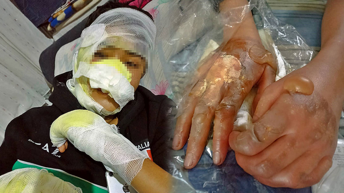 'Şaka yapıyoruz' deyip çocuğu fırına koyup yaktılar! Böyle arkadaşlık olmaz olsun...