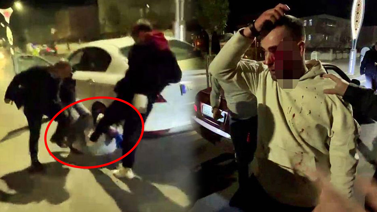 Futbol maçında dehşet: Kavgada kör oldu! Araçlarının önünü kesip feci şekilde darbettiler