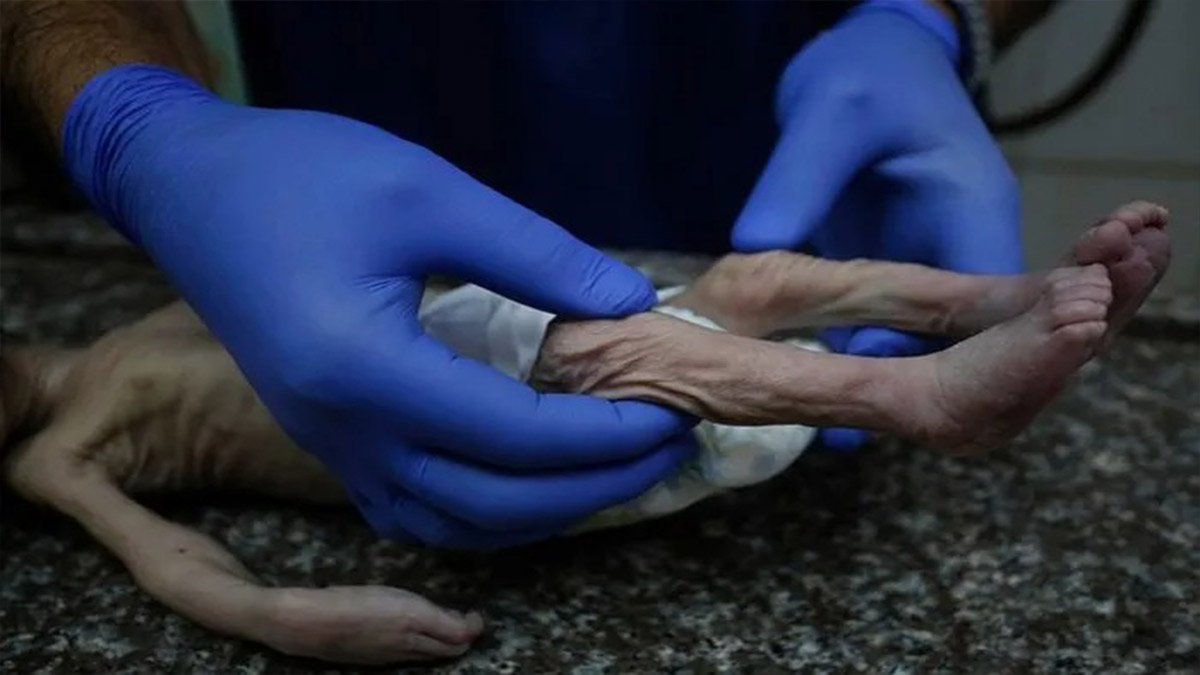 Naylon çadırlarda yaşam mücadelesi veriyorlar... Gazze'de 5 bebek donarak öldü