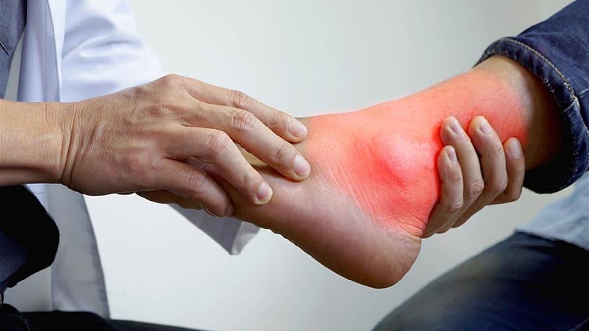 Herkes onu zengin hastalığı olarak biliyor fark edilmesi geç oluyor! En çok erkeklerde ortaya çıkıyor