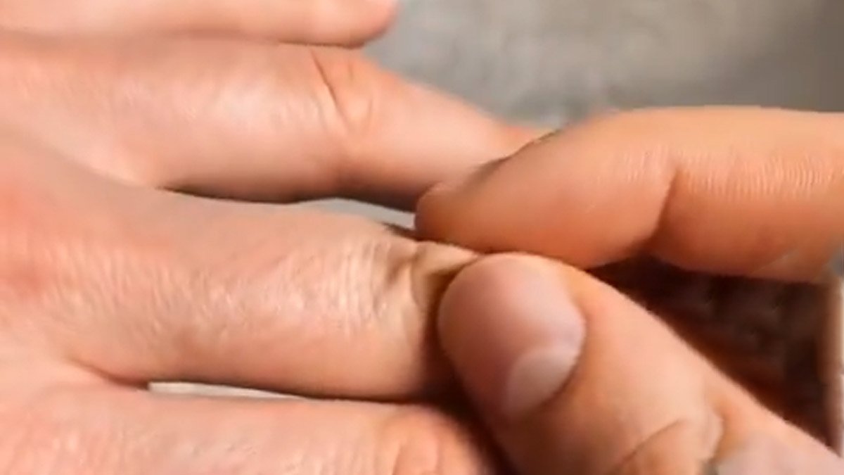 Derinizi kaldırdığınızda anında eski haline dönmüyorsa hemen musluğa koşun! İşin uzmanı kimsenin bilmediği sırrı açıkladı