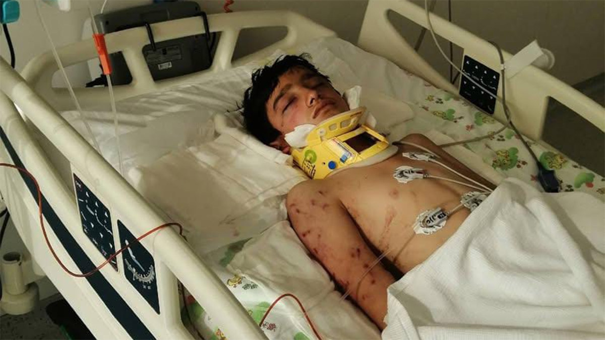 Sokak köpeklerinin saldırısına uğrayan çocuk yoğun bakımda