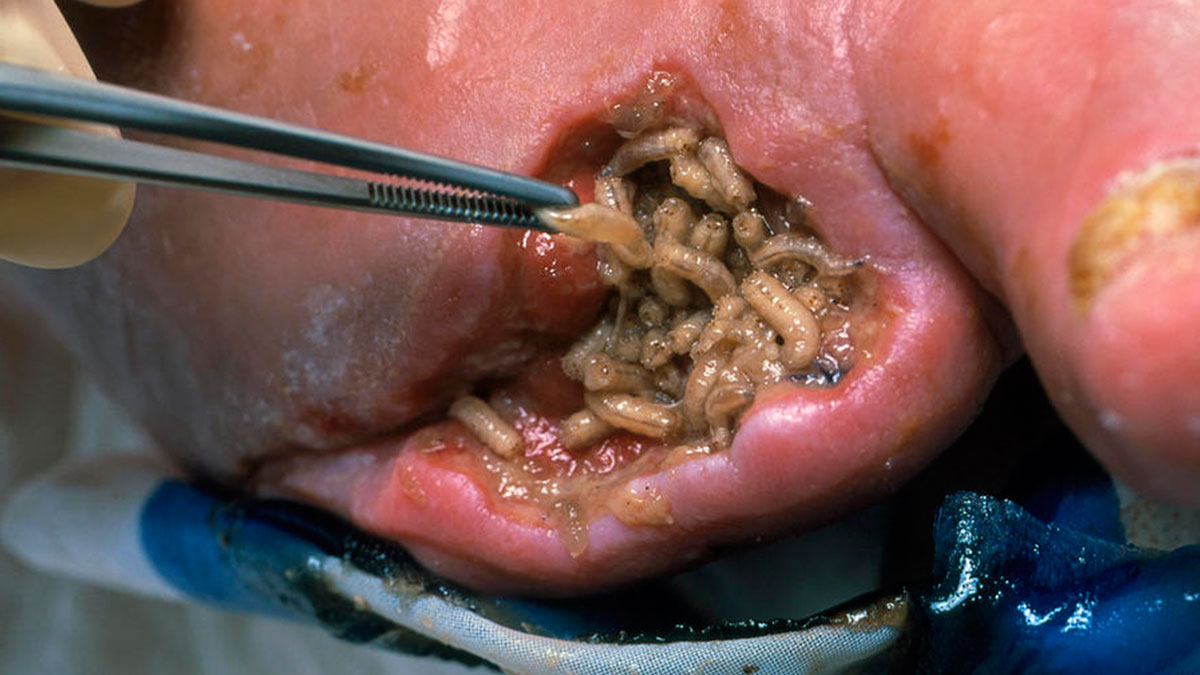 İnsan yiyen kurtçuk paniği: Açık yaradan, gözlerden, ağızdan girebiliyor! Özellikle evcil hayvanla yaşayanlar risk altında