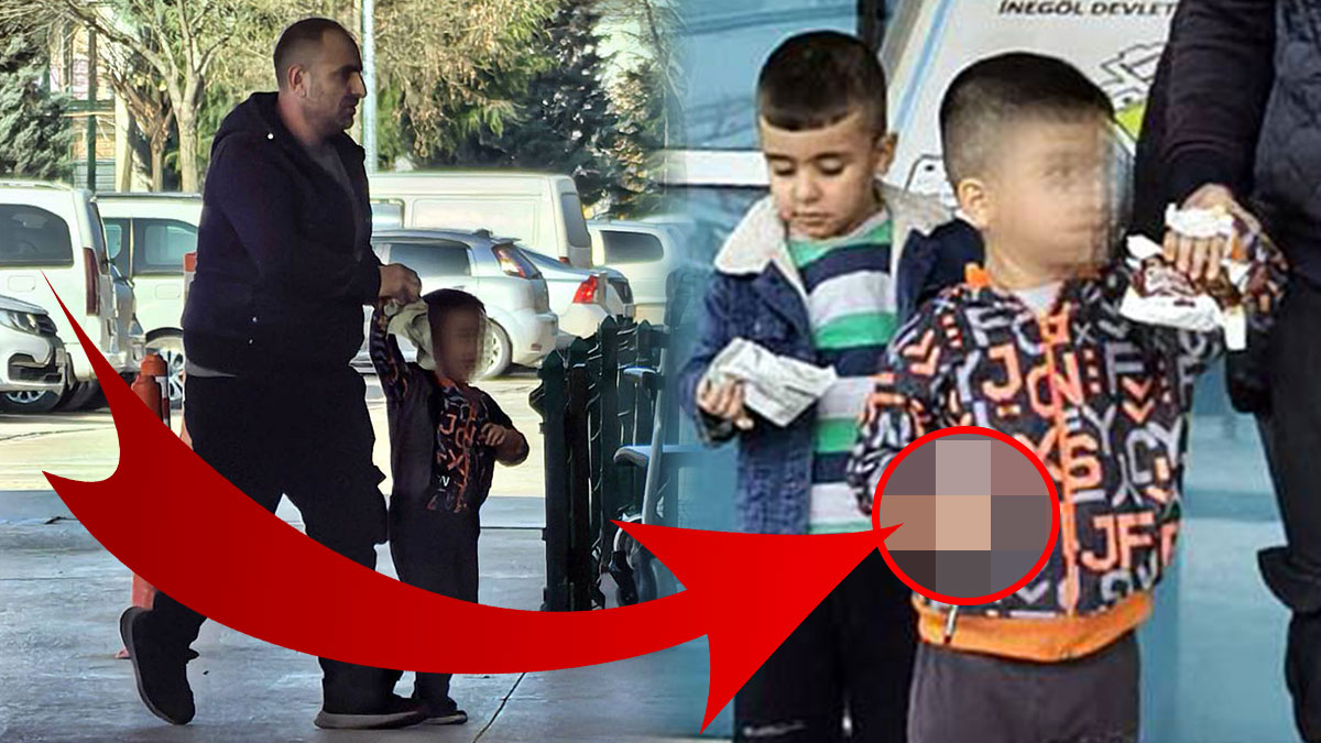 Parkta oynayan 3 yaşındaki çocuğun parmağı feci şekilde koptu! O kentte kahreden olay