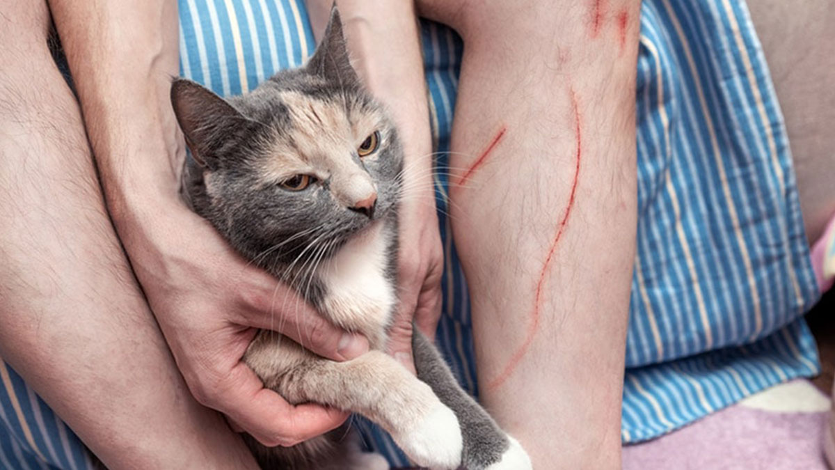 Beslediği kedisi tırmalayan adam kısmi kör oldu! Meğer sokaktan o bakteriyi eve taşımış