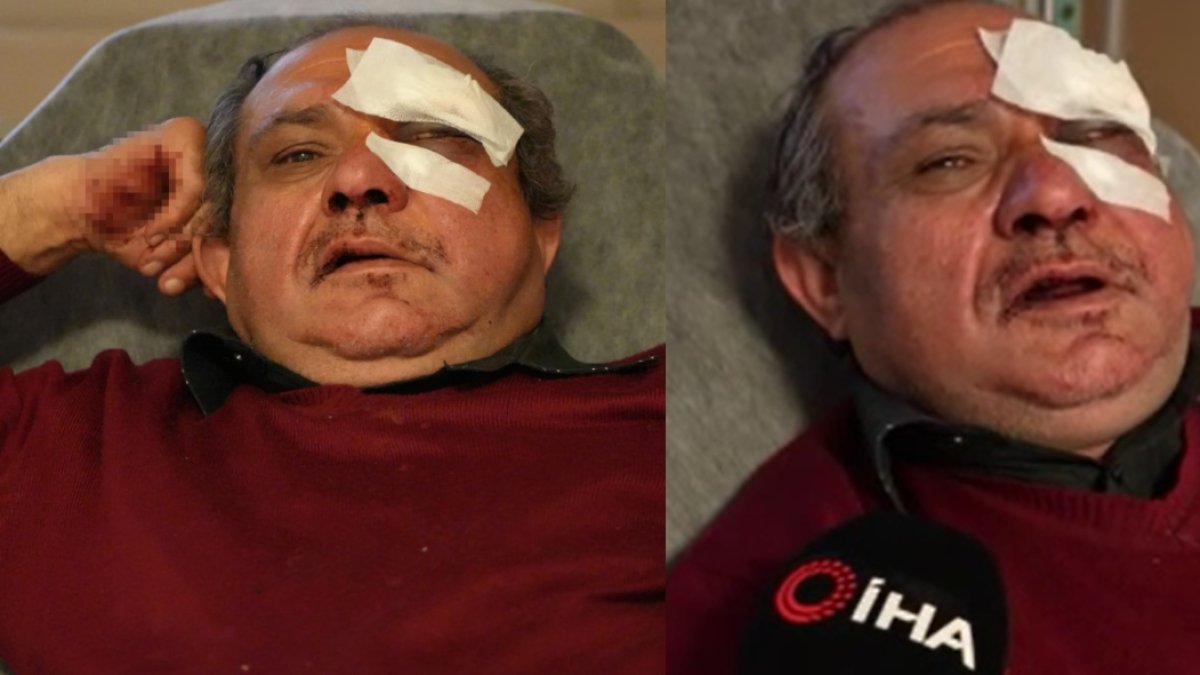 Sağlıkta şiddet dur durak bilmiyor! Darp ettikleri doktor bile sebebini bilmiyor: Göz çevresindeki kemik kırıldı