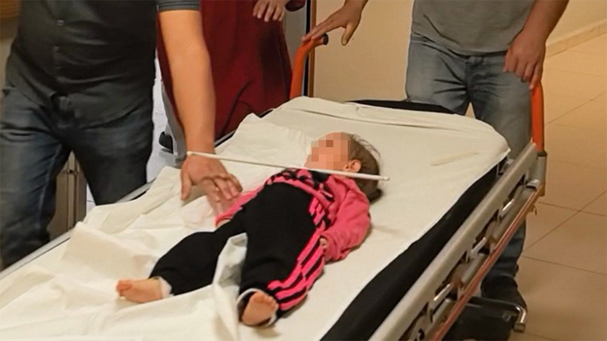 Bursa'da akılalmaz olay! 2 yaşındaki çocuğun çenesine askı saplandı