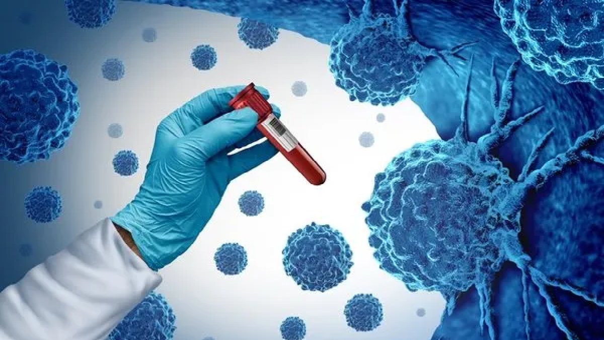 Türkiye herkesi korkutuyor! Ülkelere göre kanser sıralaması belli oldu! Bakın Türkiye kaçıncı sırada…